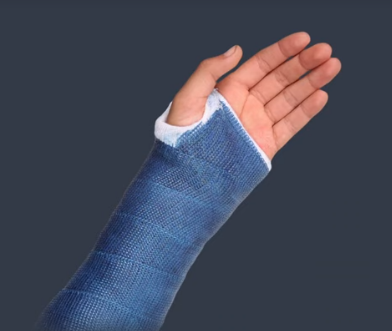 An arm in a cast from the video