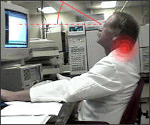 Figure 7. Stresses because of bifocal lenses