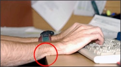 Figure 4. Contact stress from the table edge