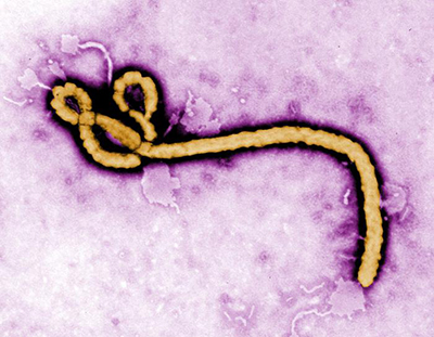 Illustration of Ebola virus